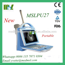 MSLPU27M New Protable Ultrasound Scanner for human with 3.5MHz convex probe